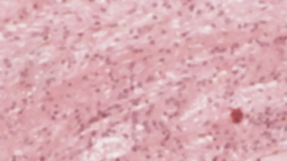 pf23