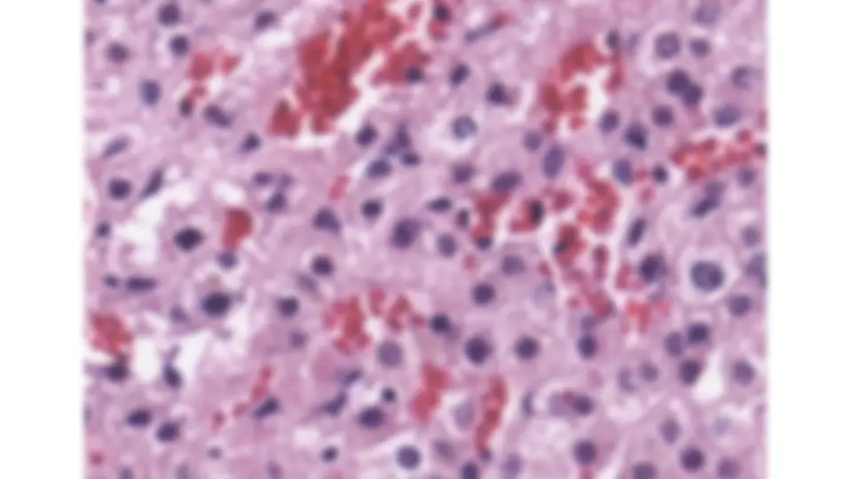 pf21