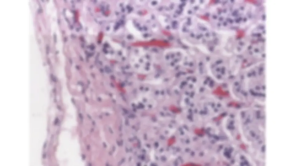 pf1a