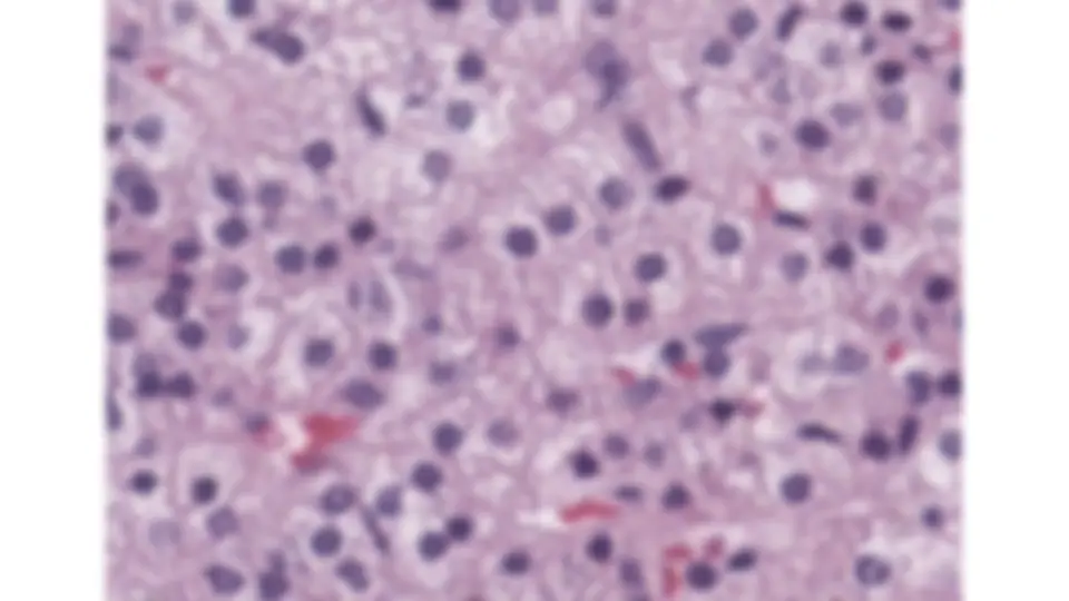 pf1f