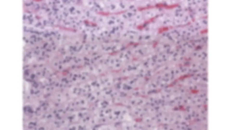 pf1c