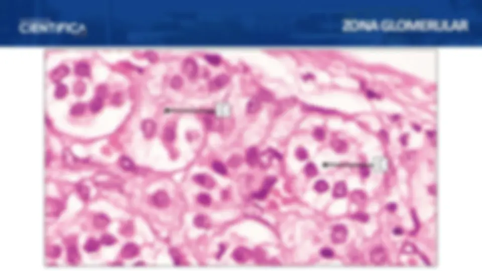 pf25