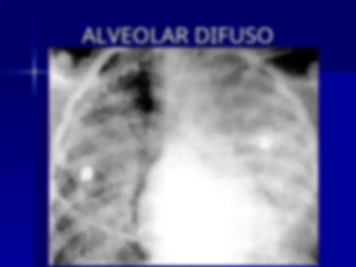 pf1b