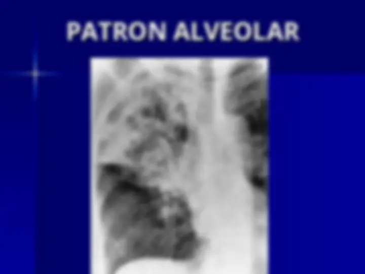 pf13