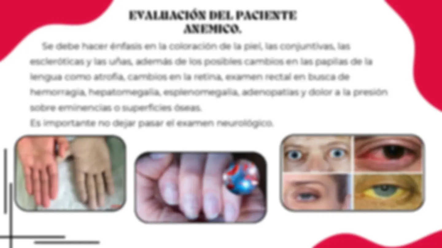 pfe