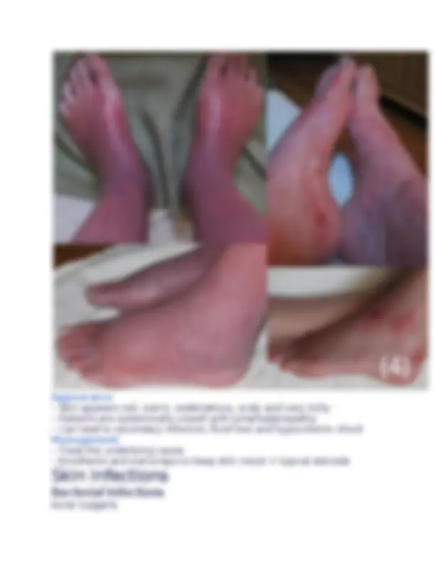 pf19