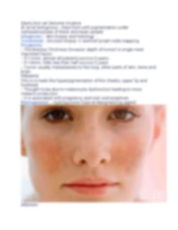 pfe