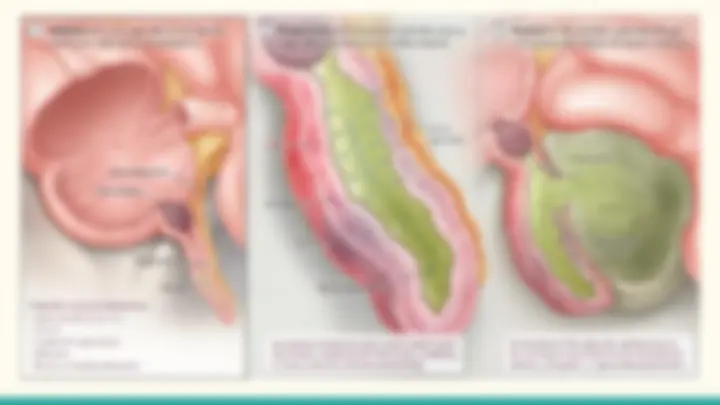 pf5