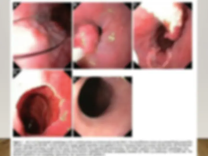 pf36