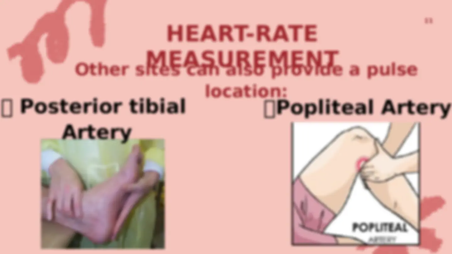 pfa