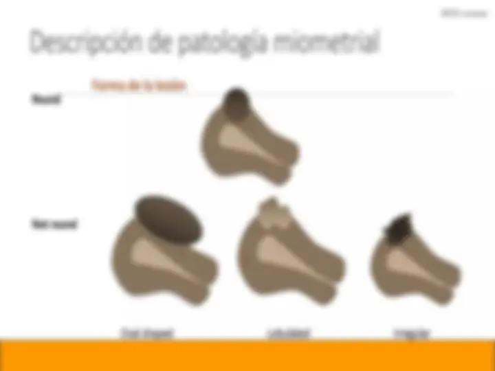 pff