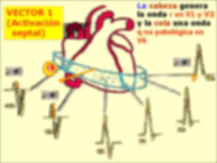 pf1b