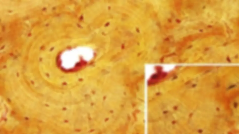 pf34