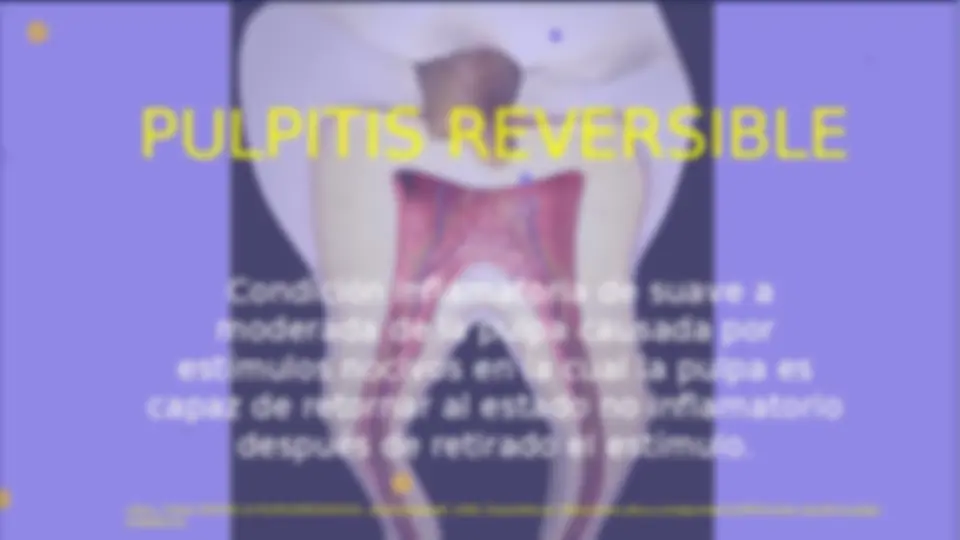 pfe