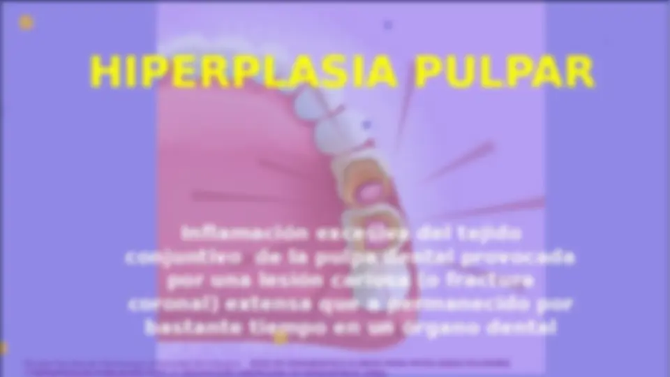 pf14