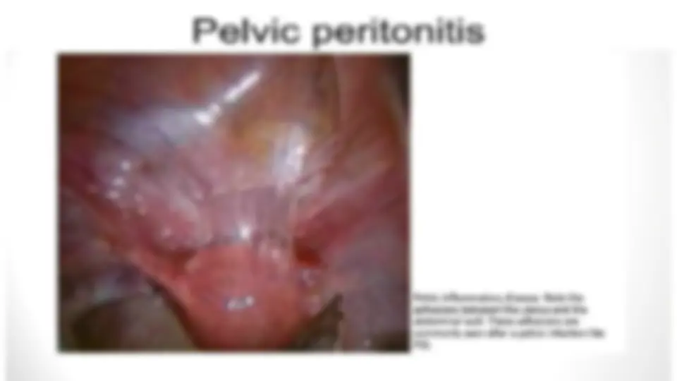 pf27