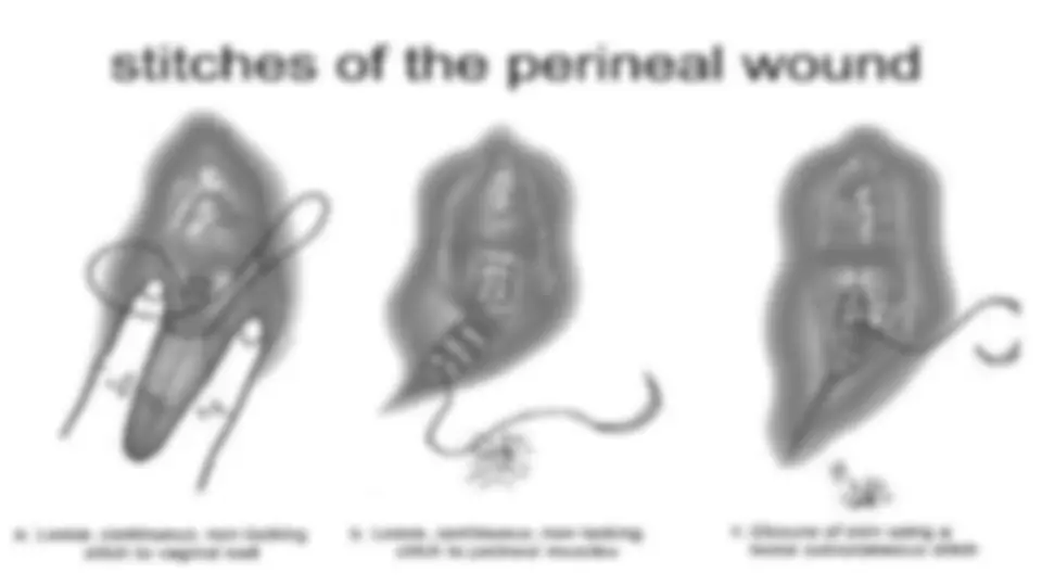 pf3f
