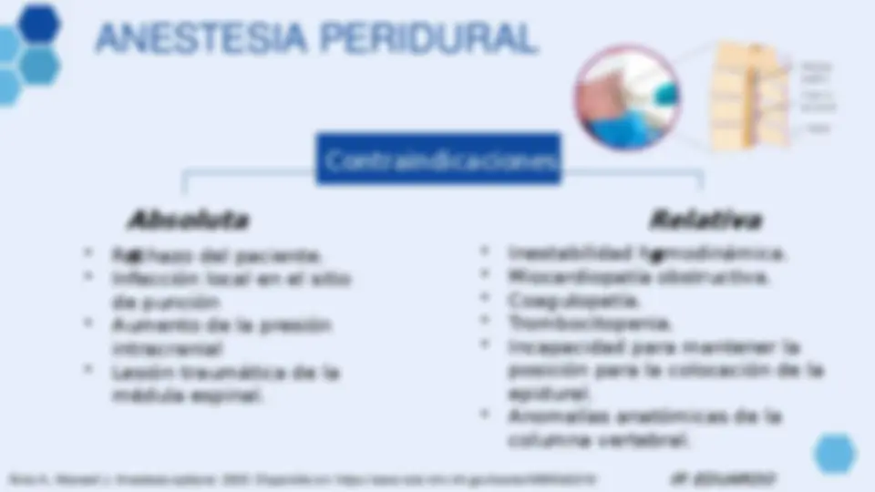 pfe