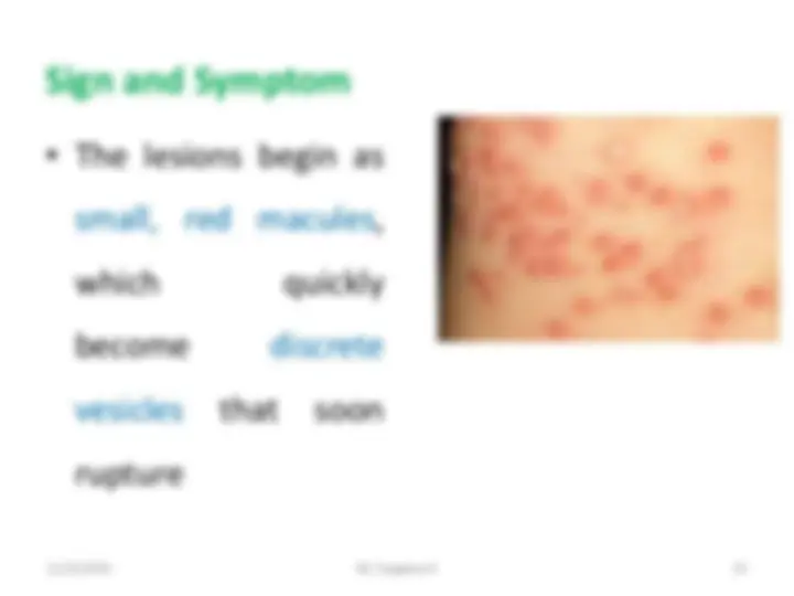 pf21