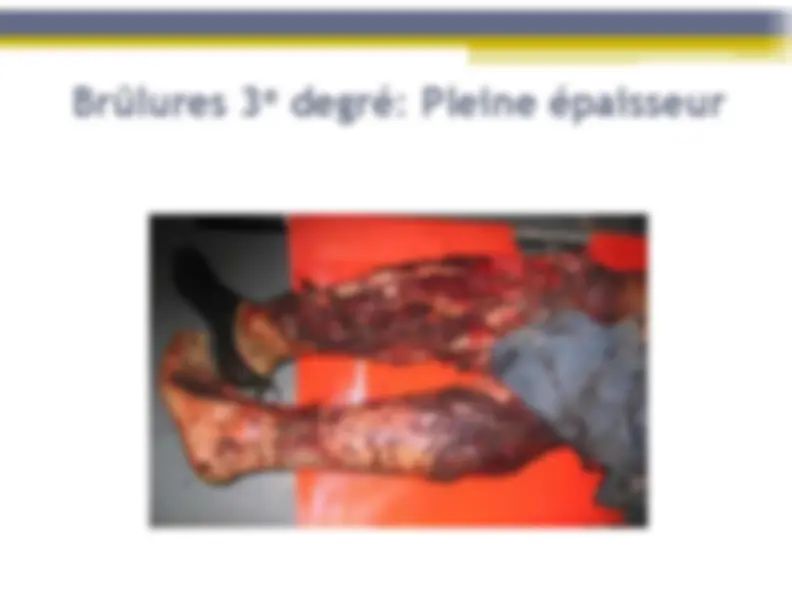pf13