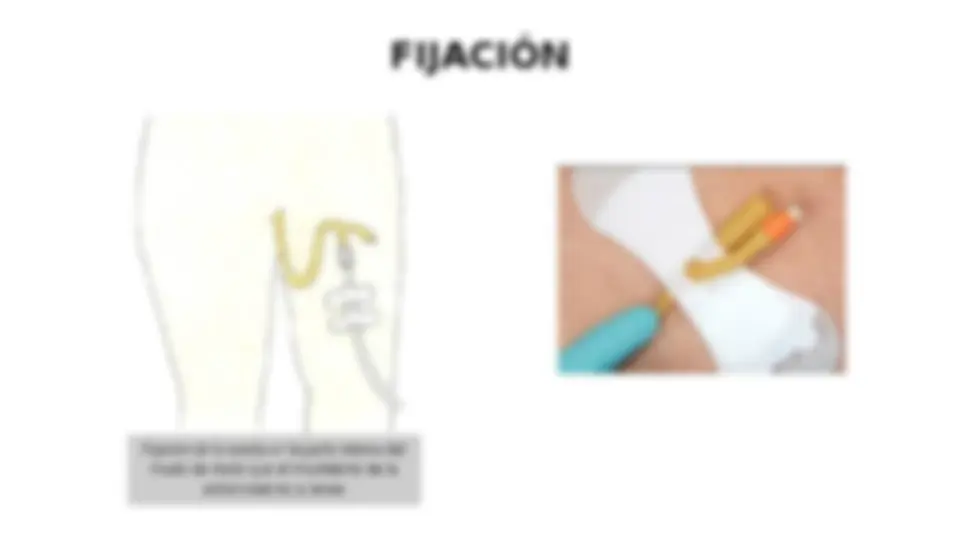 pf12