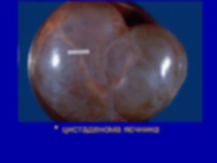 pf18