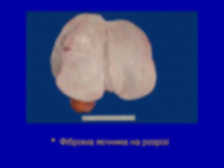 pf5c