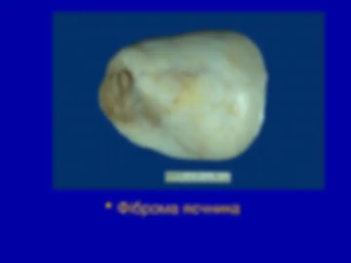 pf5b