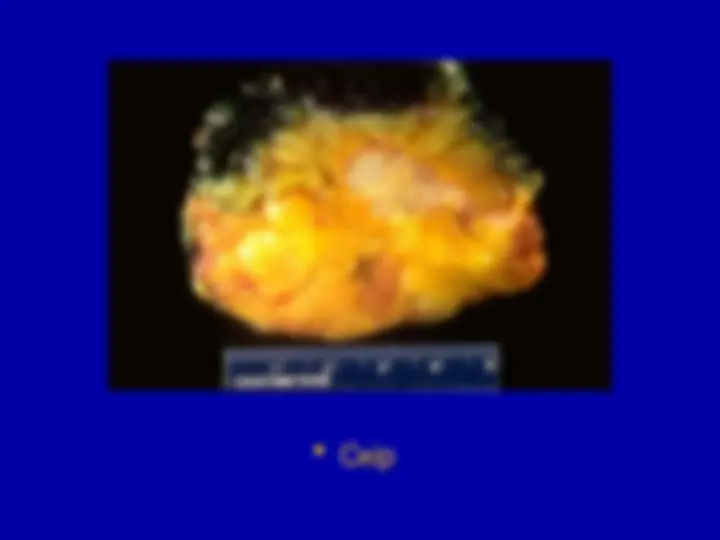 pf26
