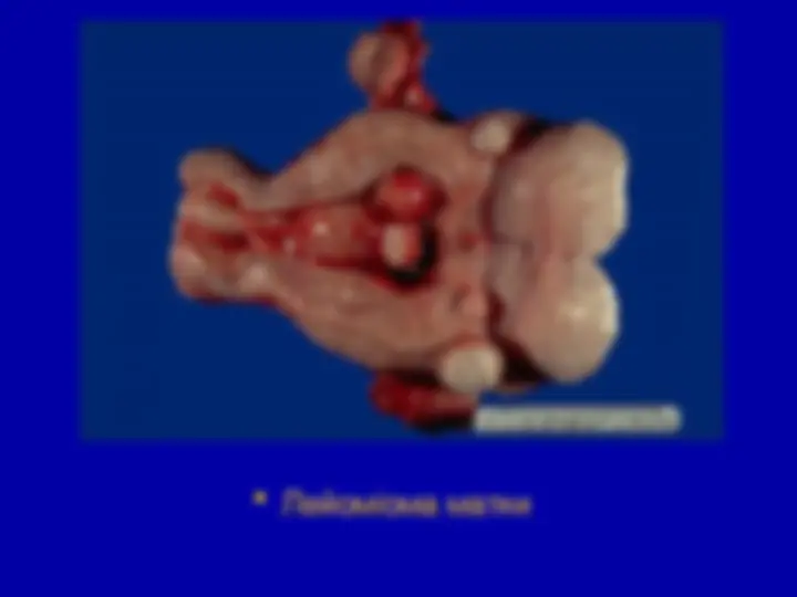 pf29