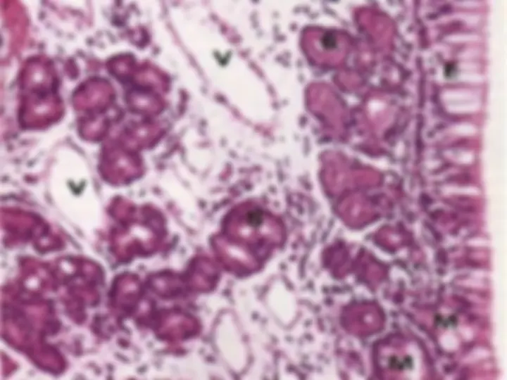 pfa