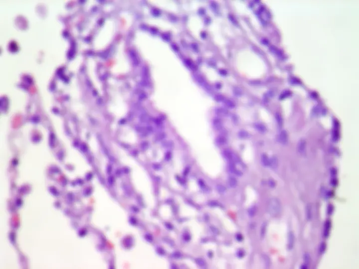 pf34