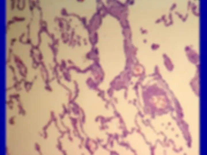 pf35