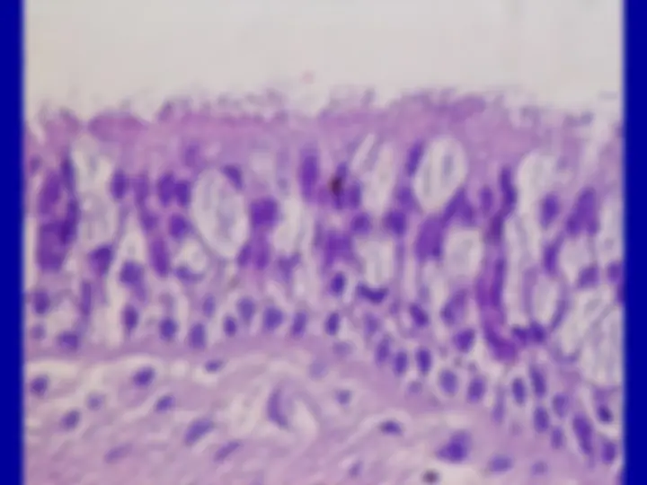 pf24