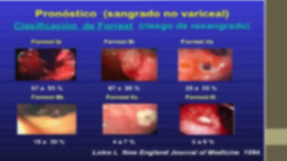 pf32