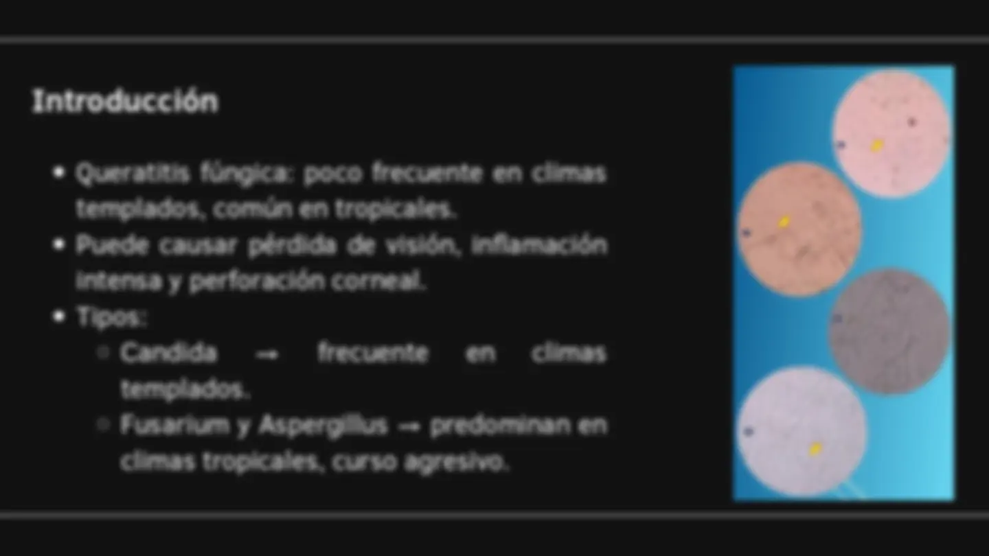 pfe