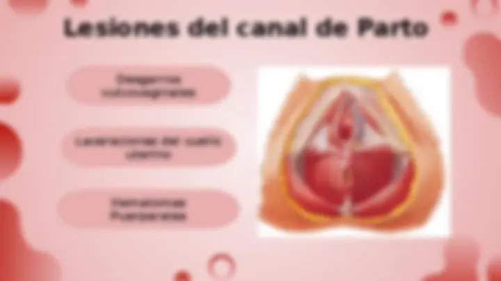 pf12