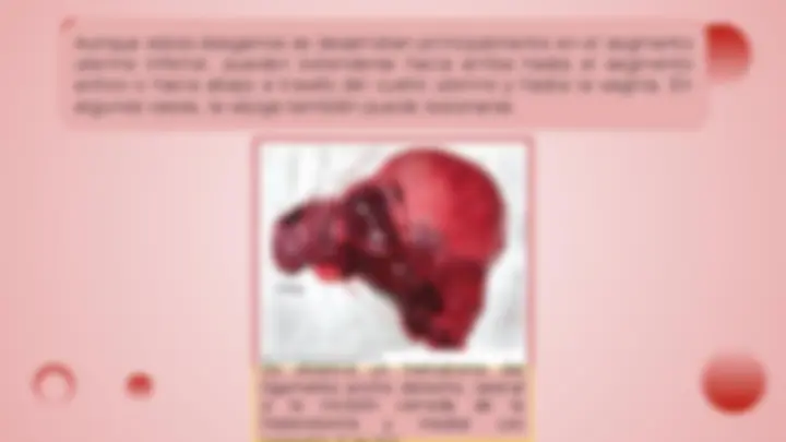 pf1e