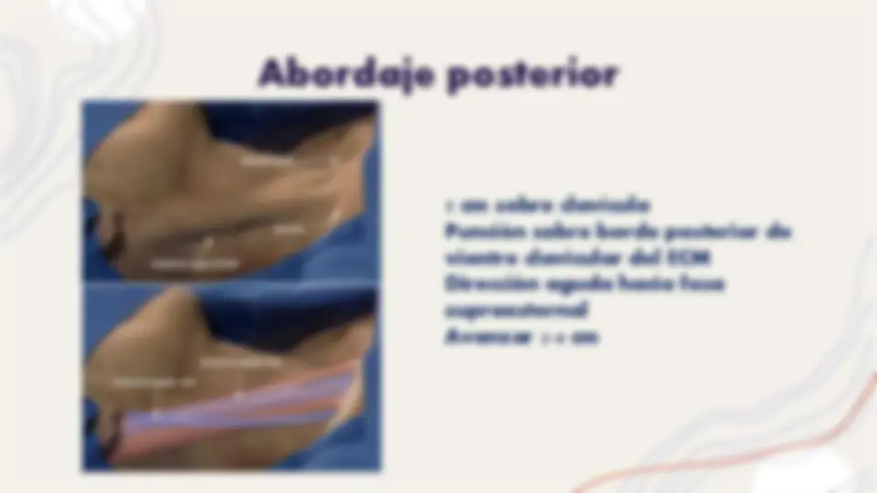 pf1d