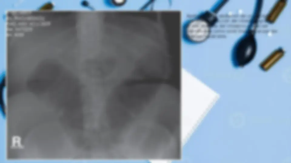 ABDOMEN AGUDO CIRUGIA GENERAL | Summaries Medicine | Docsity