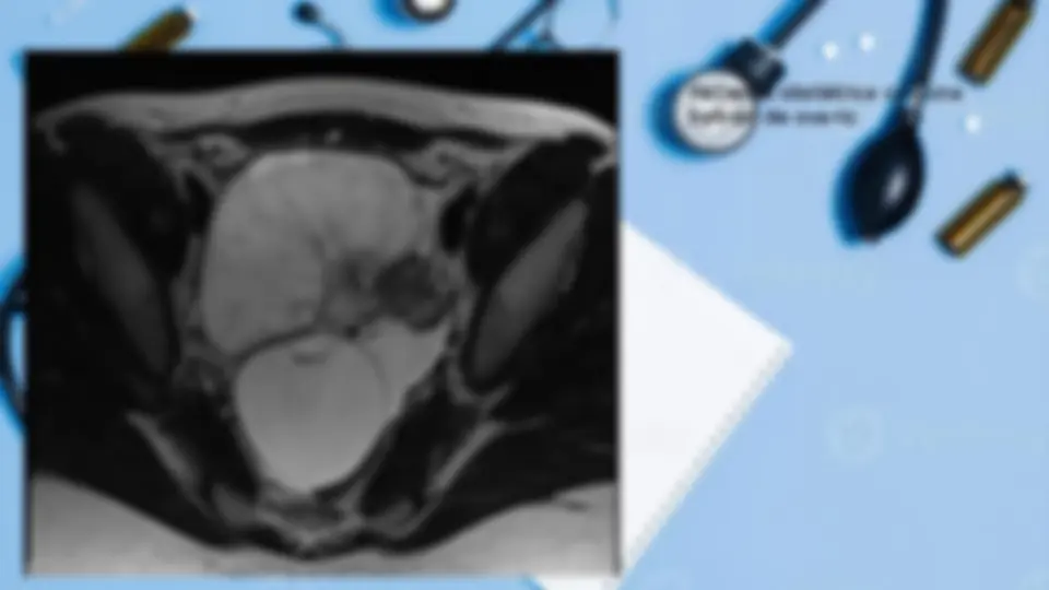 ABDOMEN AGUDO CIRUGIA GENERAL | Summaries Medicine | Docsity