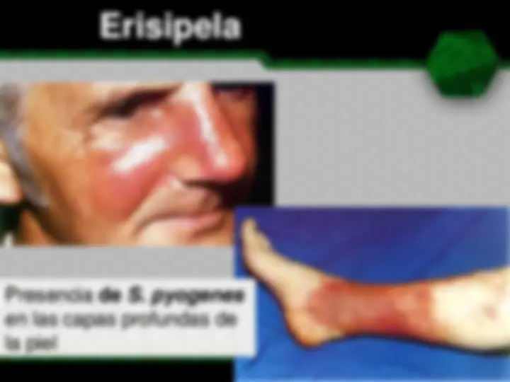 pf17