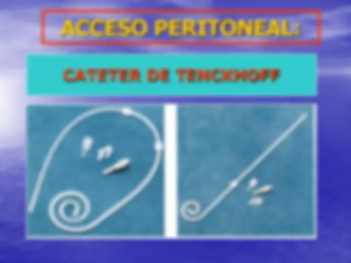 pf24