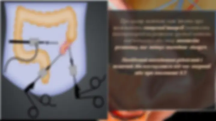pfe