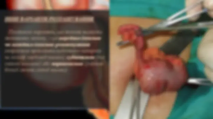 pff