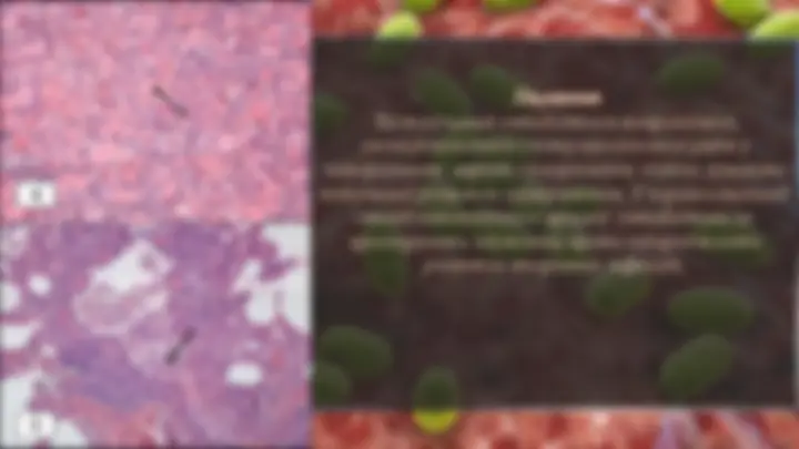 pf17