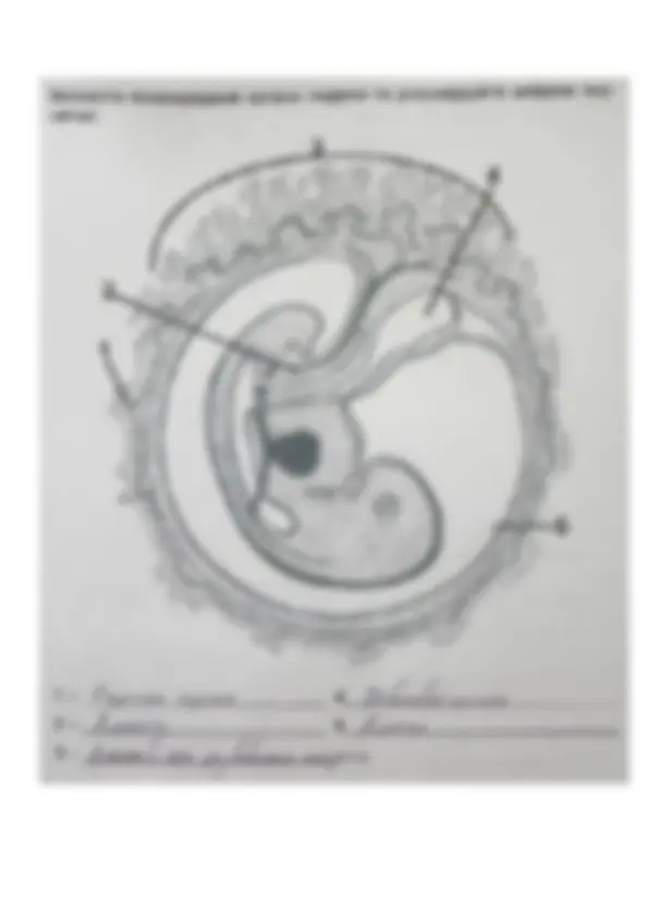 pfa