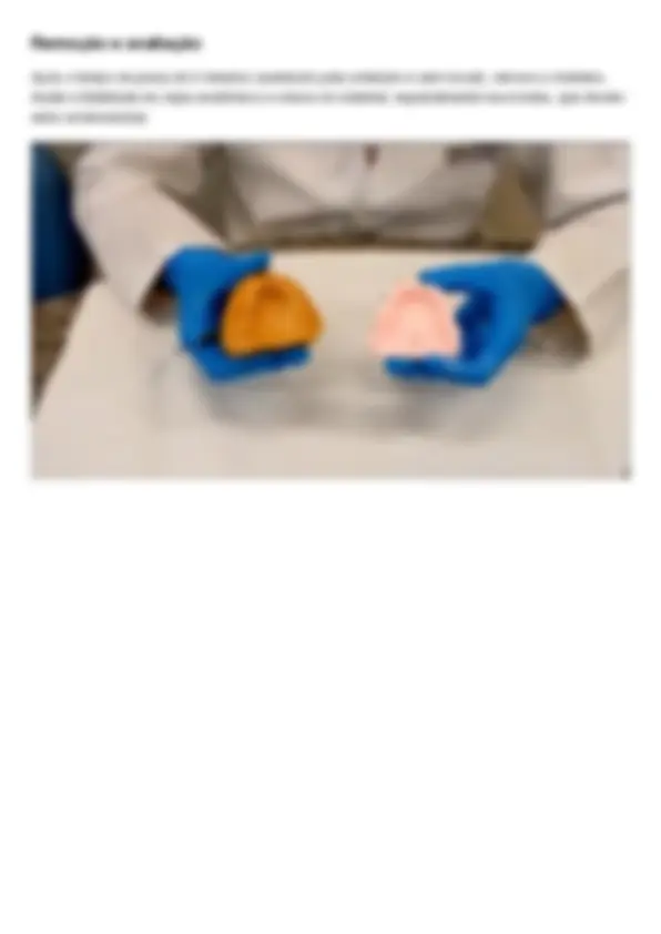 pf4