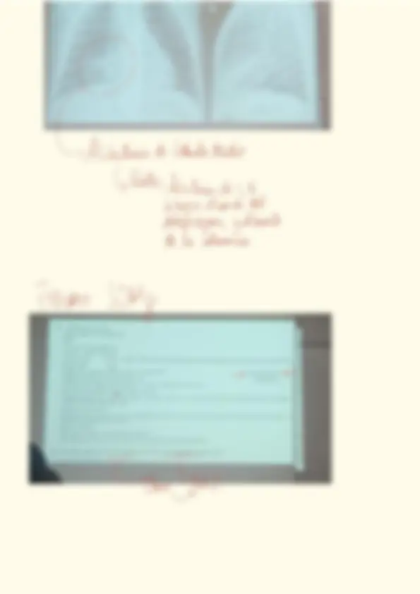 pf4