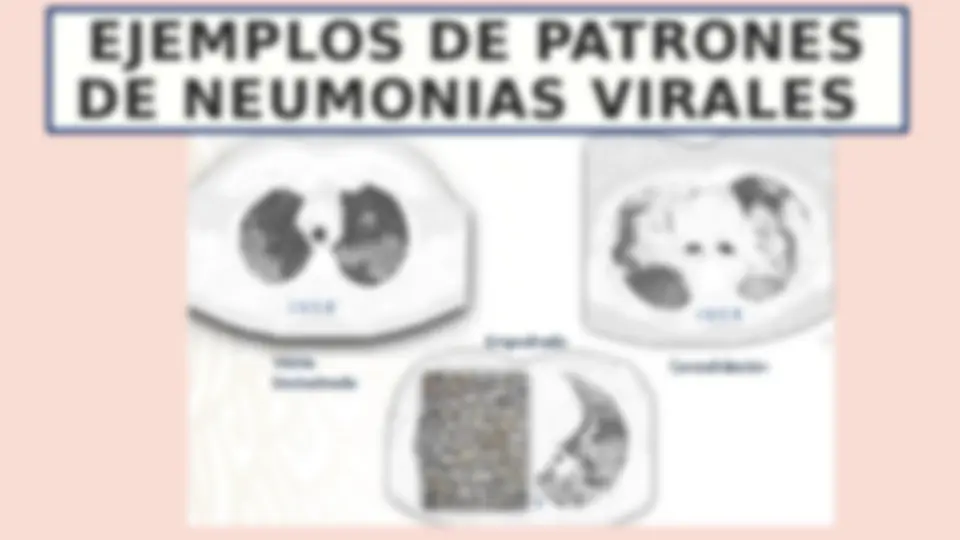 pfd